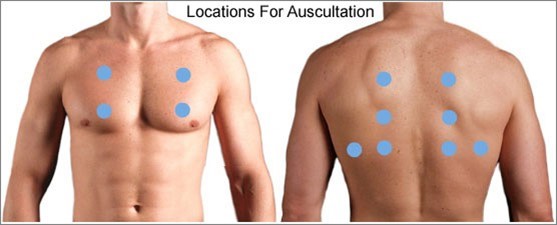 Auscultation