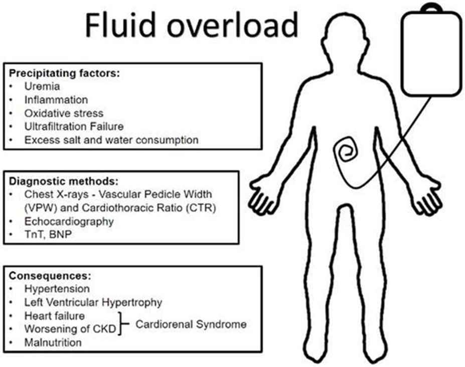 fluid overload