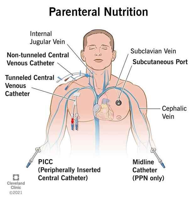 Parental Nutrition