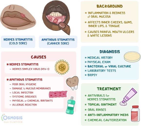 A nurse is caring for a client who has stomatitis followi | Nursing Exam