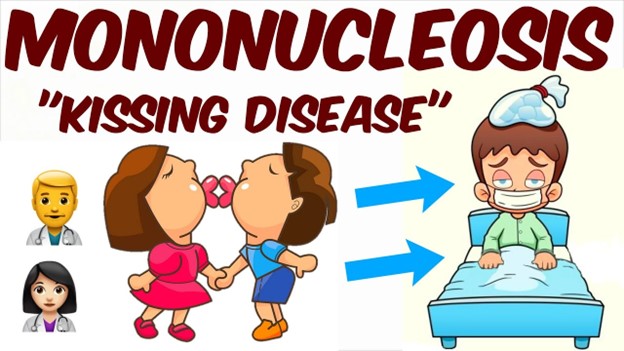 Mononucleosis (Mono/Kissing Disease): Symptoms and Causes
