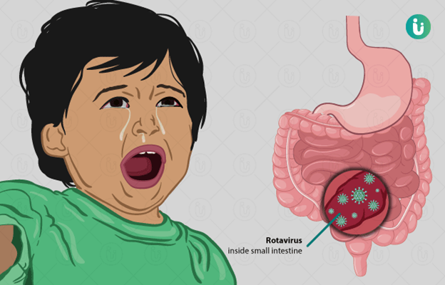 The viral pathogen that frequently causes acute diarrhea | Nursing Exam