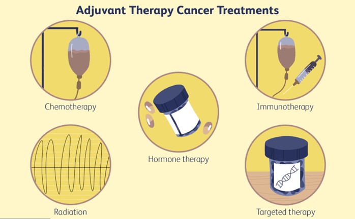 Adjuvant Therapy for Cancer: Types, Benefits, Side Effects