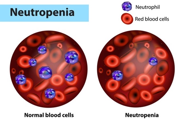 What Causes Neutropenia?
