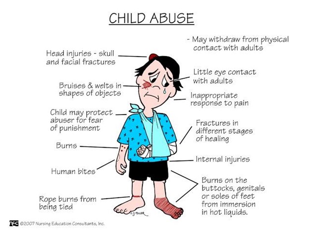 Types of Child Abuse and Neglect - Pediatrics
