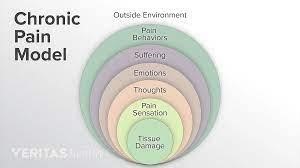 Chronic Pain Model