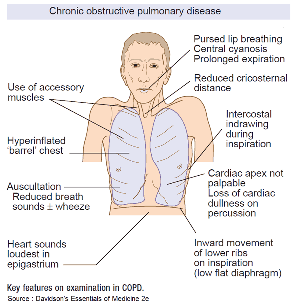 Physical Therapy Intervention For Pulmonary Diseases - ppt video online  download