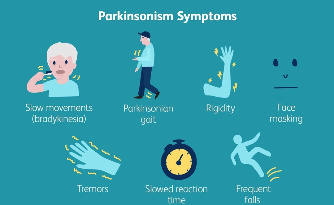 extrapyramidal syndrome