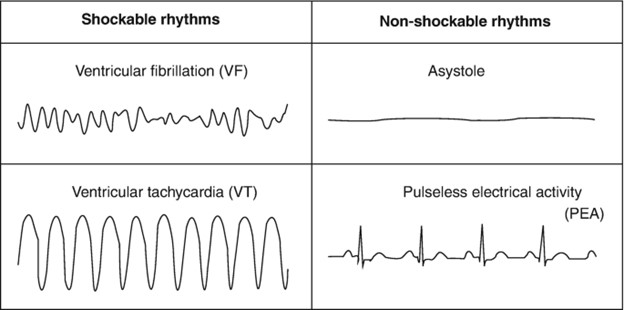 Special Considerations Pediatric Emergency Care