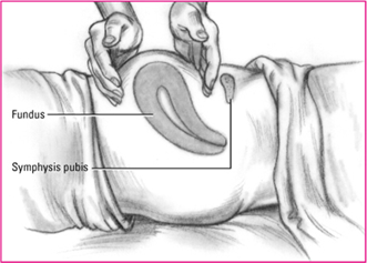 Fundal palpation (postpartum) | Nurse Key