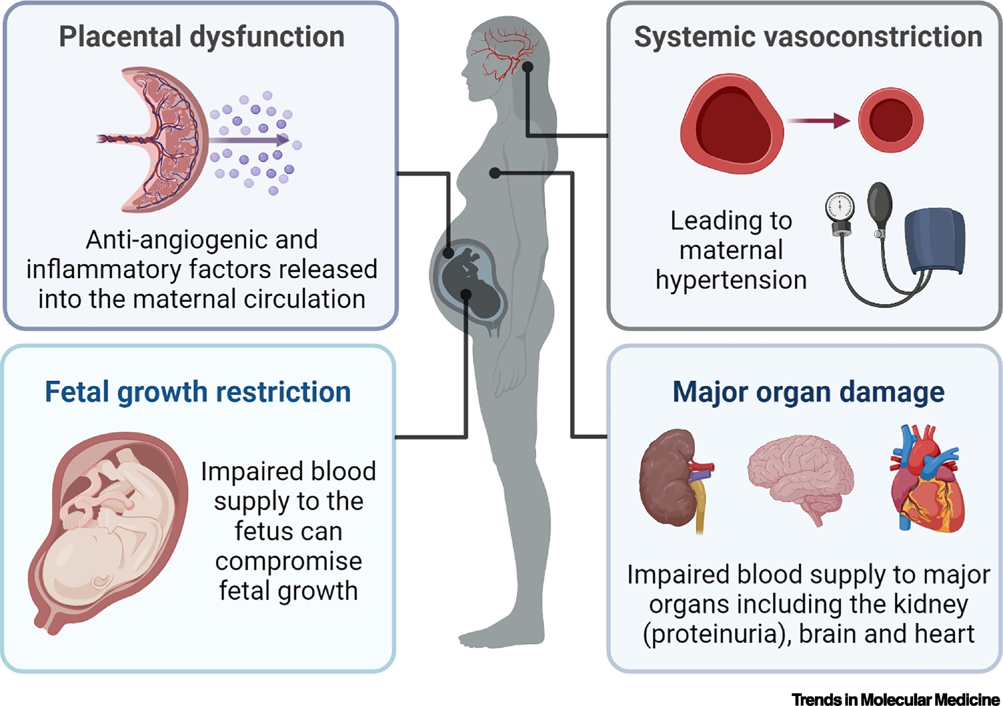 Pre-eclampsia: Challenges for Nanomedicine Development in Pregnancy: Trends  in Molecular Medicine