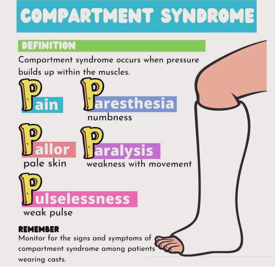 Understanding compartment syndrome by type